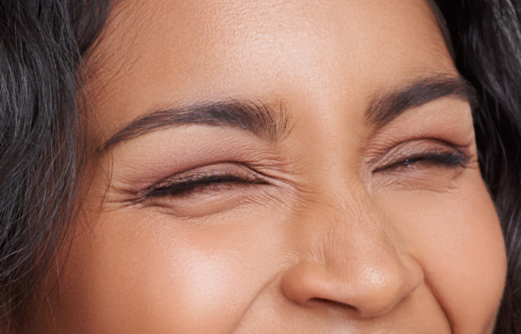 Muse Instant Eyelift Before and After
